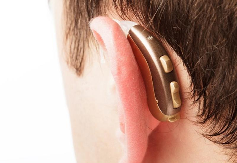 IMPLANTE COCLEAR, SAN ISIDRO