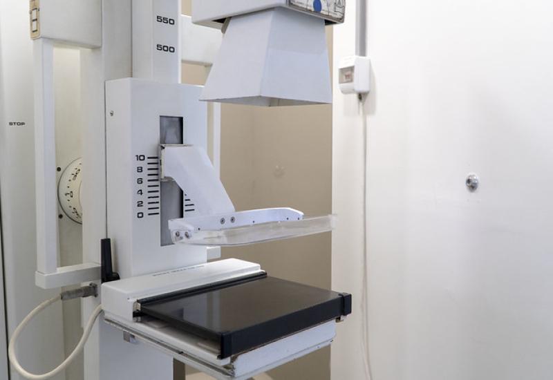 MAMOGRAFÍO HOSPITAL DE BOULOGNE