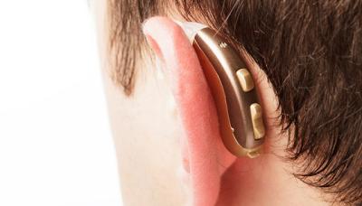 IMPLANTE COCLEAR, SAN ISIDRO