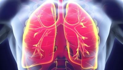 TUBERCULOSIS